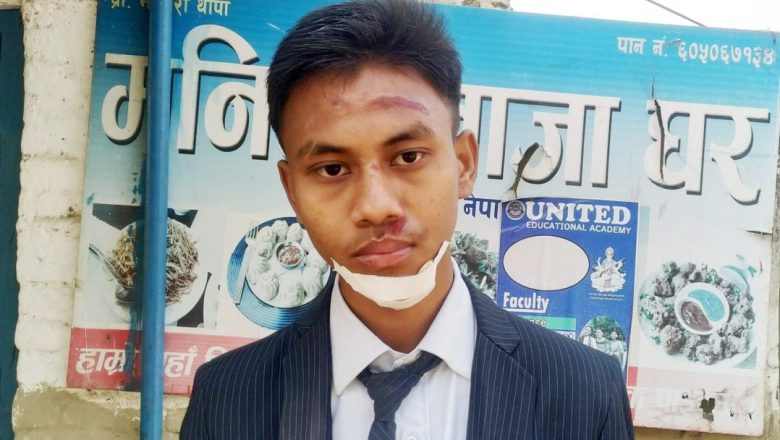 नेपालगञ्जमा लुटेराहरु सक्रिय, विहानै विद्यार्थिको मोबाइल लुटियो