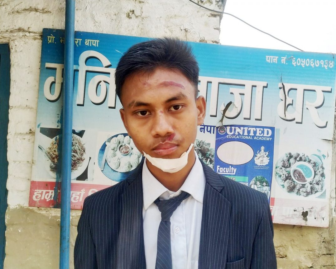 नेपालगञ्जमा लुटेराहरु सक्रिय, विहानै विद्यार्थिको मोबाइल लुटियो